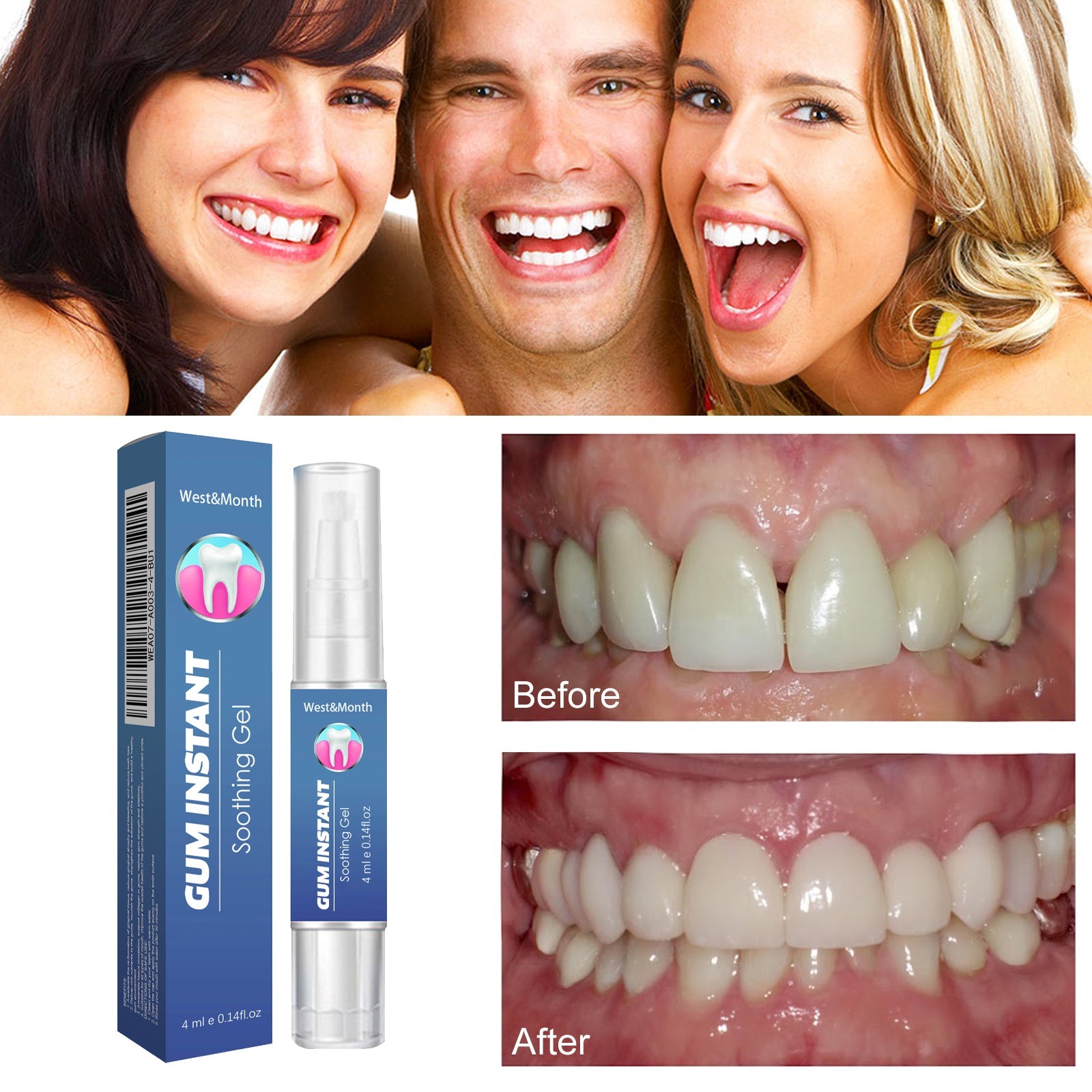 WestMonth Gum Instant Soothing Gel, Relieve Gums Swelling And Pain Clean Teeth Plaque Stains And Whiten Teeth Gel - Korvel