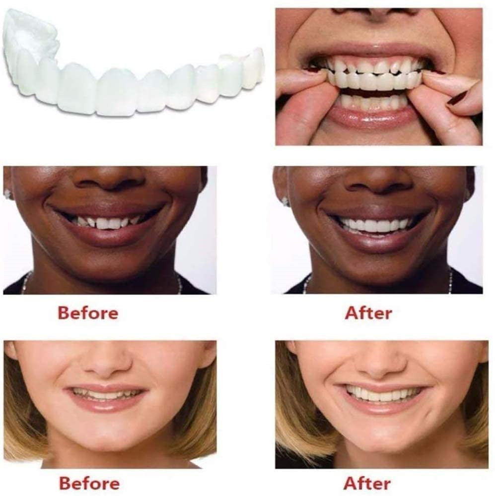 Upper Teeth And Lower Teeth Simulation Braces Non-Porous Braces Whitening Sleeves Second-Generation Silicone Simulation Teeth Dentures - Korvel