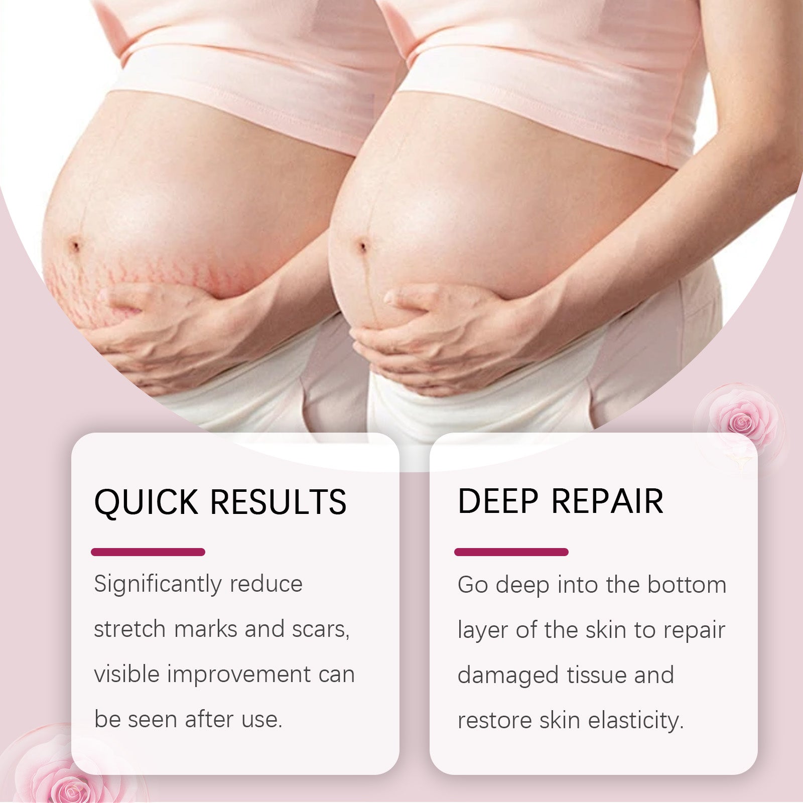 Skin Care Oil Moisturizes Postpartum Skin Fine Lines And Enhances Elasticity With A Moisturizing Cream For The Body - Korvel