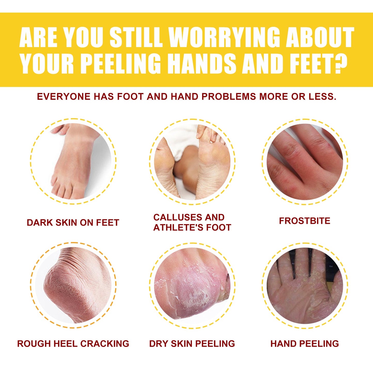 Horse Oil Hand And Foot Repair Cream, Chapped Skin Care Moisturizing And Anti-Peeling Repair Cream - Korvel