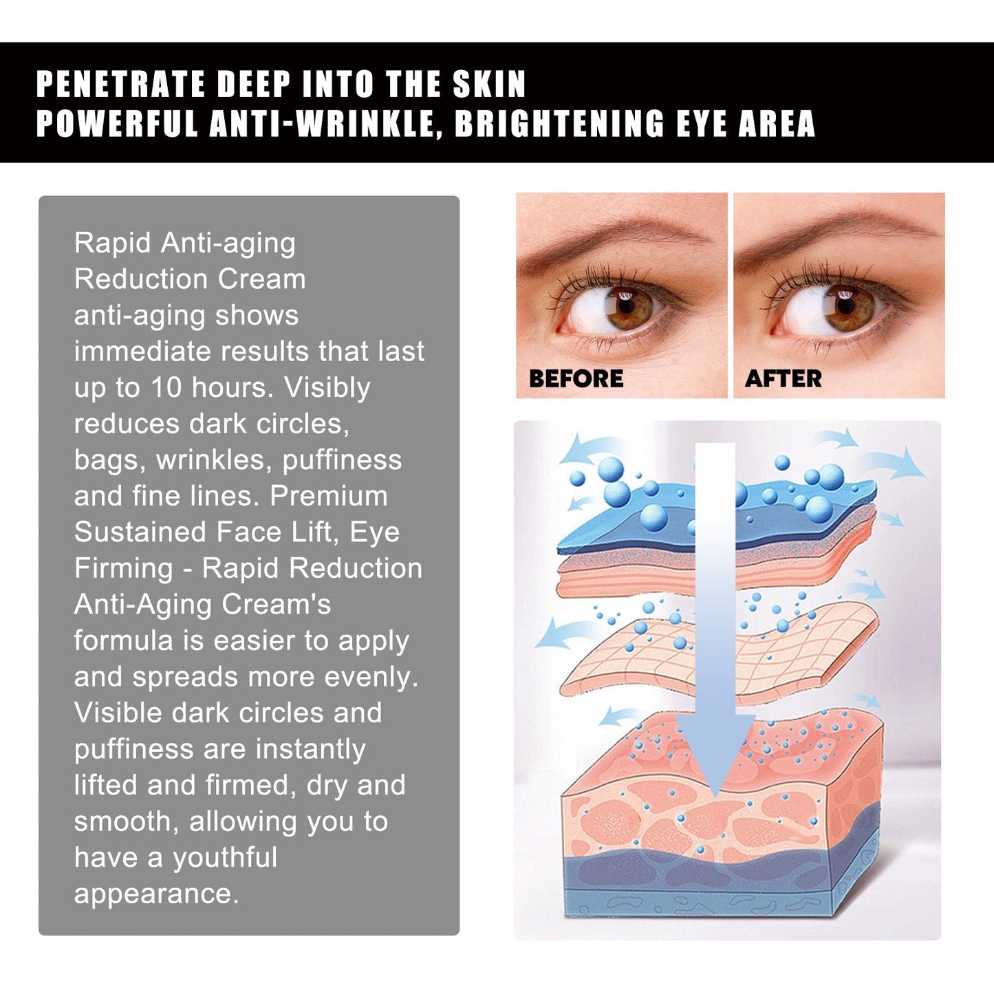 Strawberry Gel Patch Reduces Fine Lines Under Eyes, Bags Under Eyes, Dark Circles, Firming Eyes, Anti-Wrinkle Moisturizing Eye Patch - Korvel