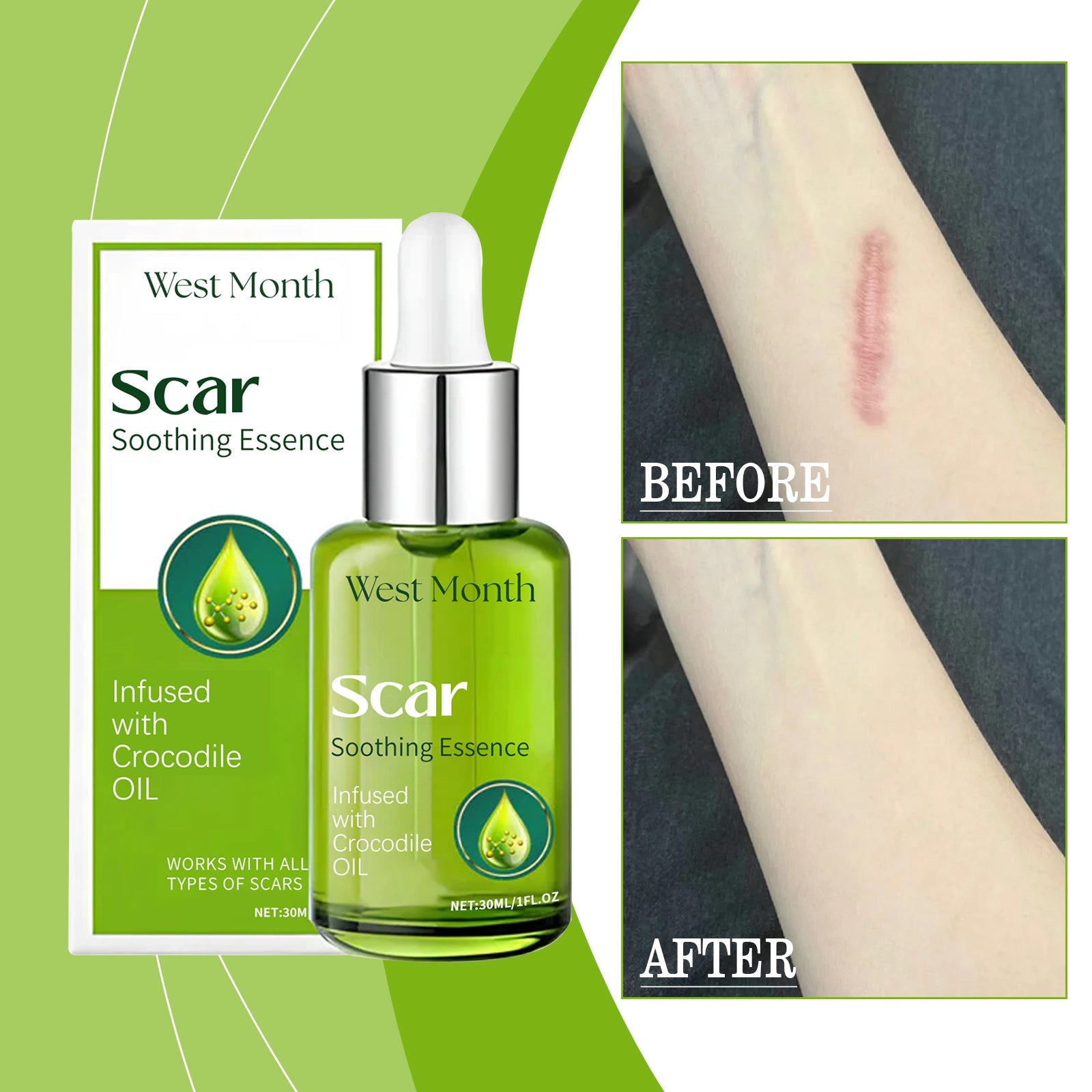 Skin Repair Essence, Body Skin Moisturizing, Firming And Rejuvenating Care Essence - Korvel