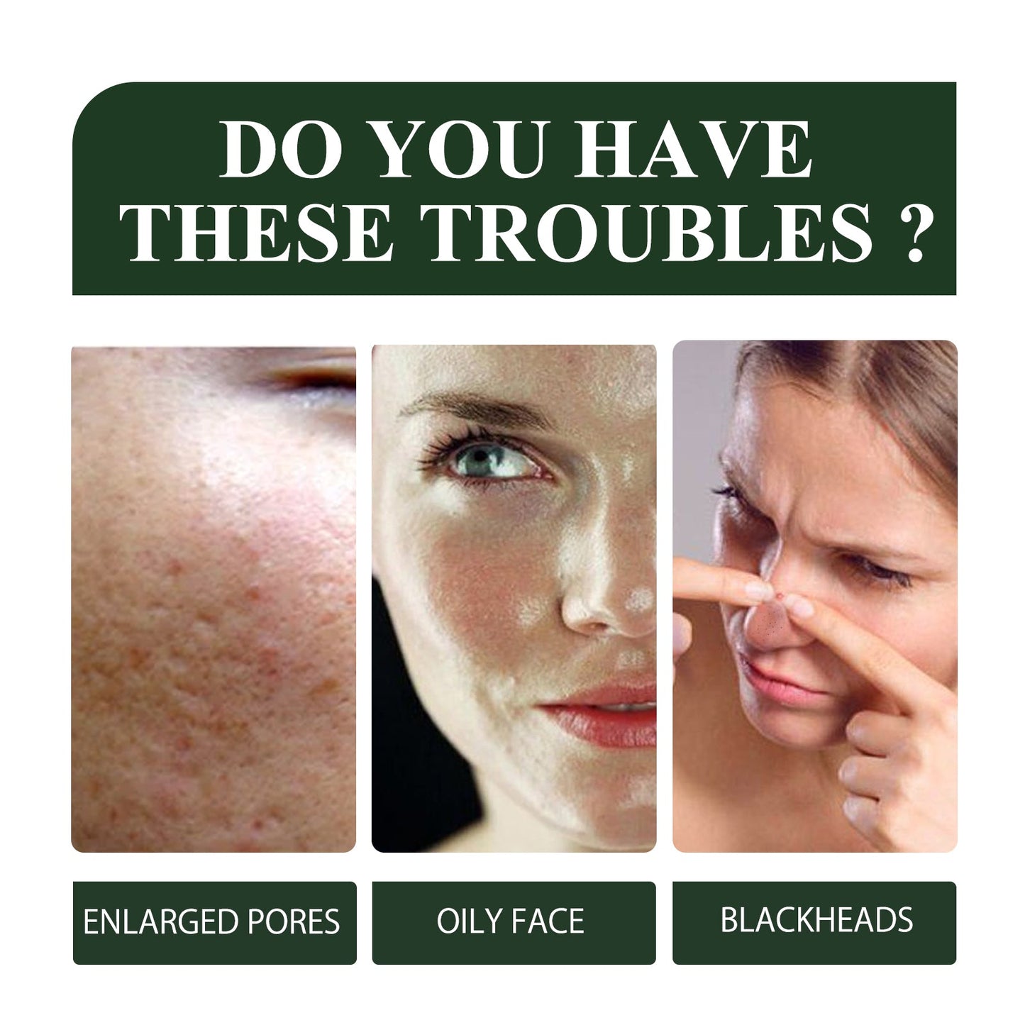 Green Tea Blackhead Removal Mask Deeply Cleanses Skin, Tightens Pores And Lightens Blackheads - Korvel