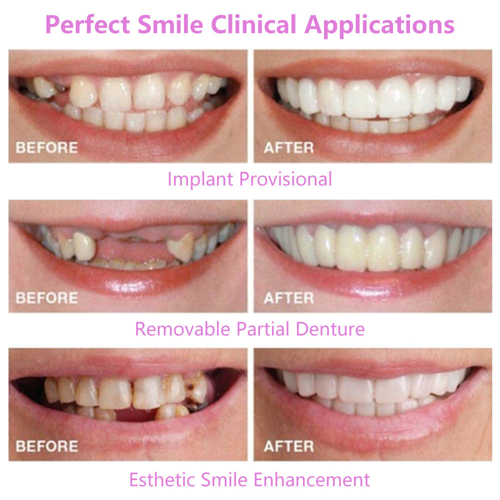 Upper Teeth And Lower Teeth Simulation Braces Non-Porous Braces Whitening Sleeves Second-Generation Silicone Simulation Teeth Dentures - Korvel