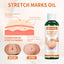 Pregnancy Massage Oil, Repair Pregnant Women Prenatal And Postpartum Stretch Mark Skin Care Massage Oil - Korvel