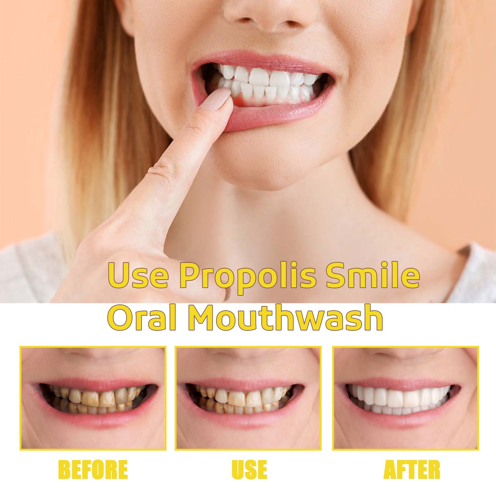 Propolis Oral Cleaning Mousse Oral Cleaning Care Tooth Stain Removal Fresh Mousse Toothpaste - Korvel