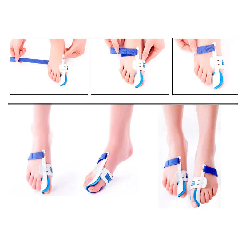 Bunion Device Hallux Valgus Orthopedic Braces Toe Correction Night Foot Corrector Thumb Goodnight Daily Big Bone Orthotics - Korvel