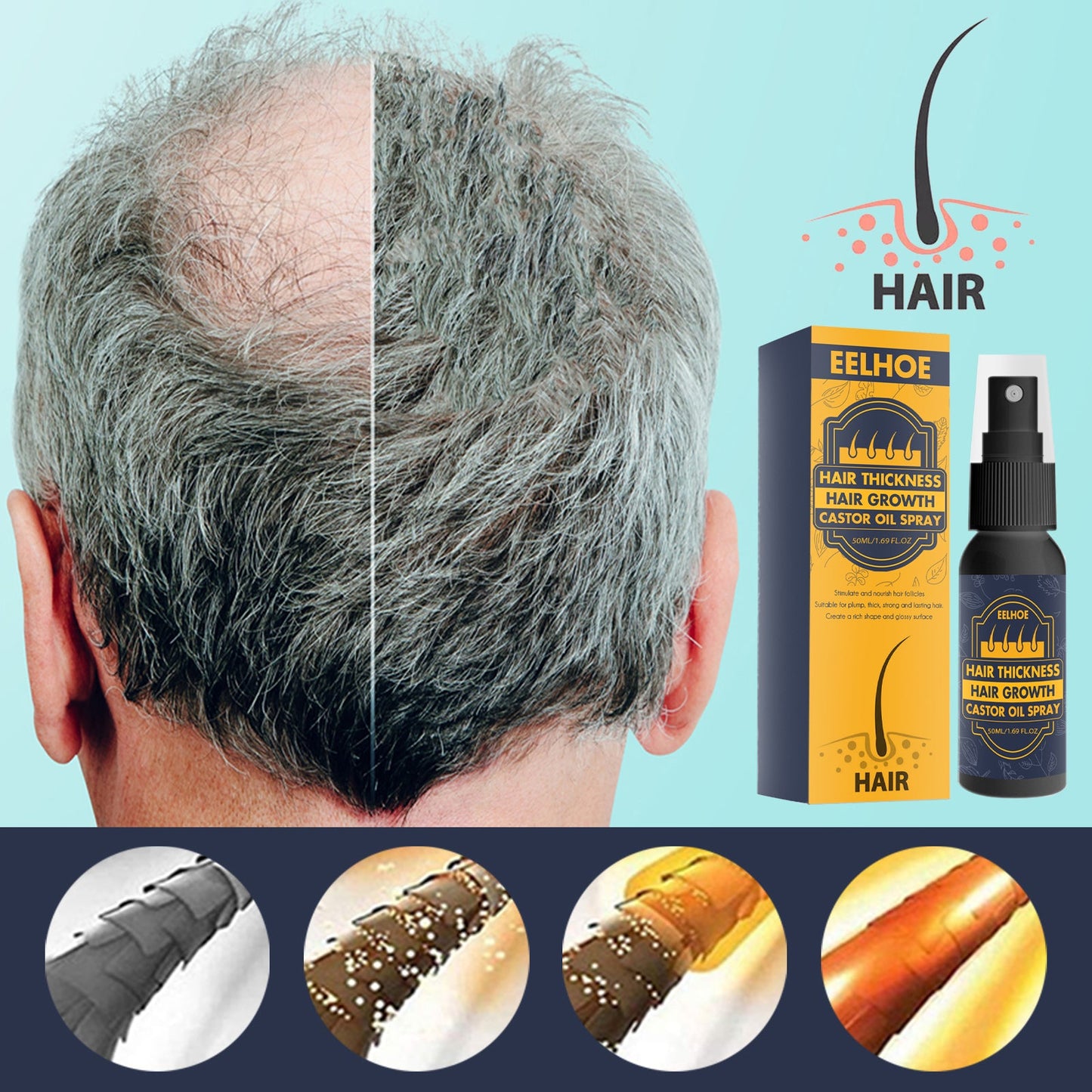 Dense Castor Oil Nutrient Solution, Hair Prevention, Moisturizing Hair Follicles Massage Repair Hair Hair - Korvel