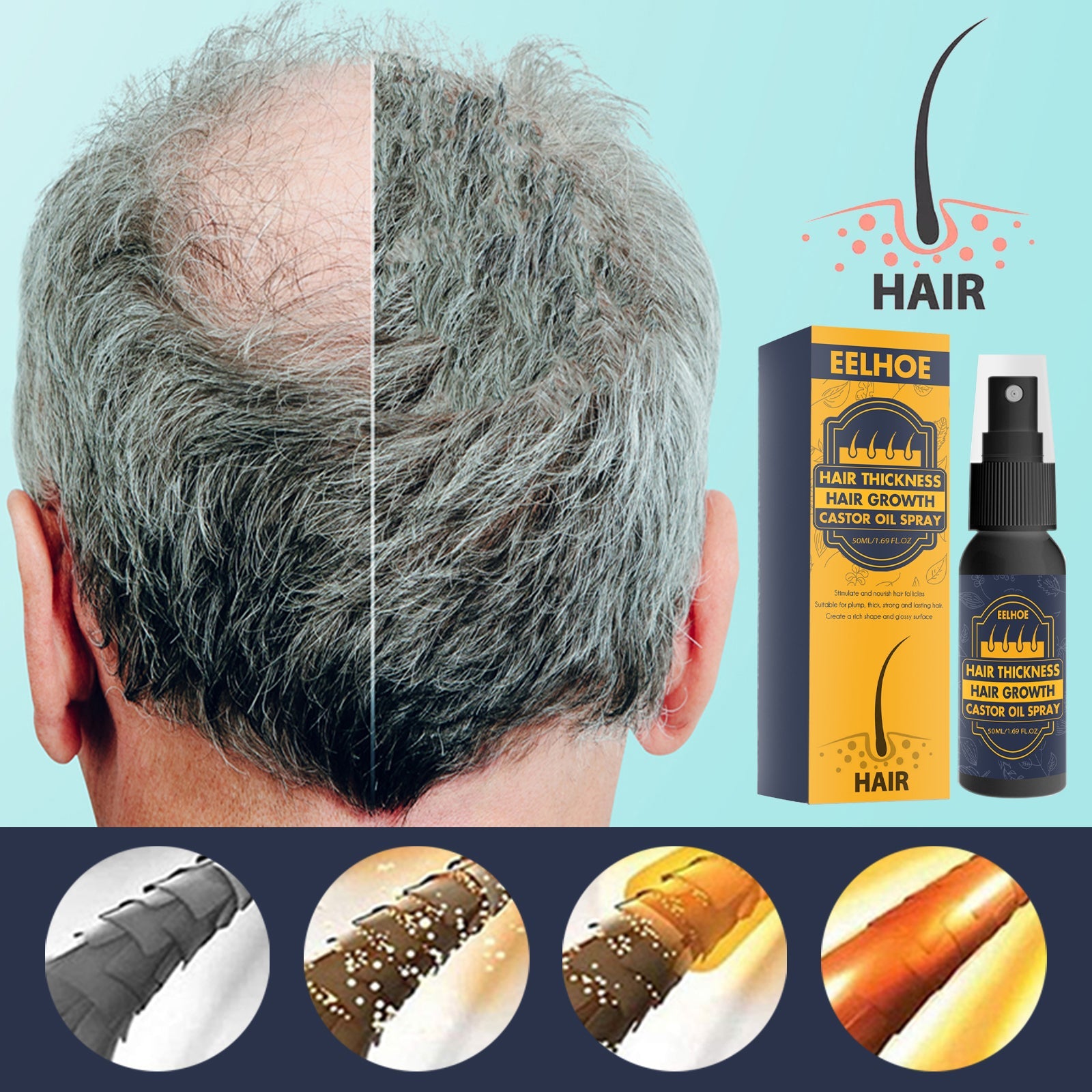 Dense Castor Oil Nutrient Solution, Hair Prevention, Moisturizing Hair Follicles Massage Repair Hair Hair - Korvel