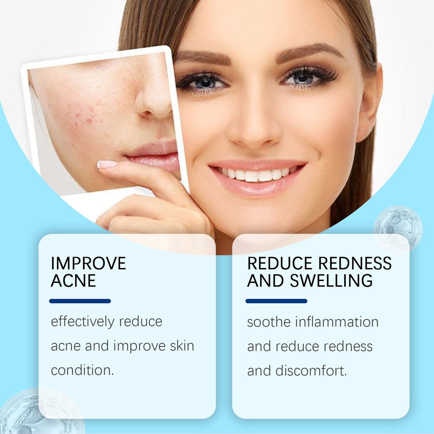 Retinol Gel Gently Cleanses Face Acne Care And Improves Skin Gel - Korvel