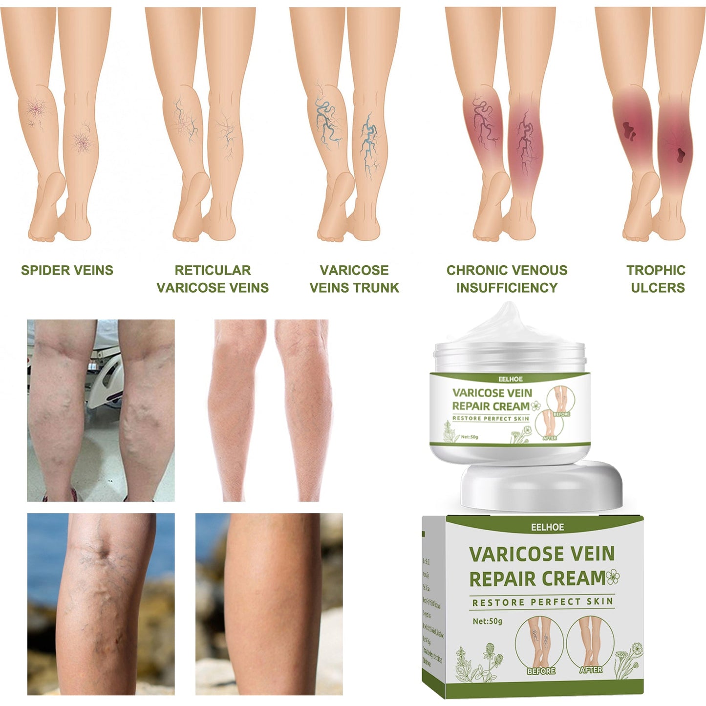 Crème Réparatrice Premium pour les Jambes - Confort et Soin