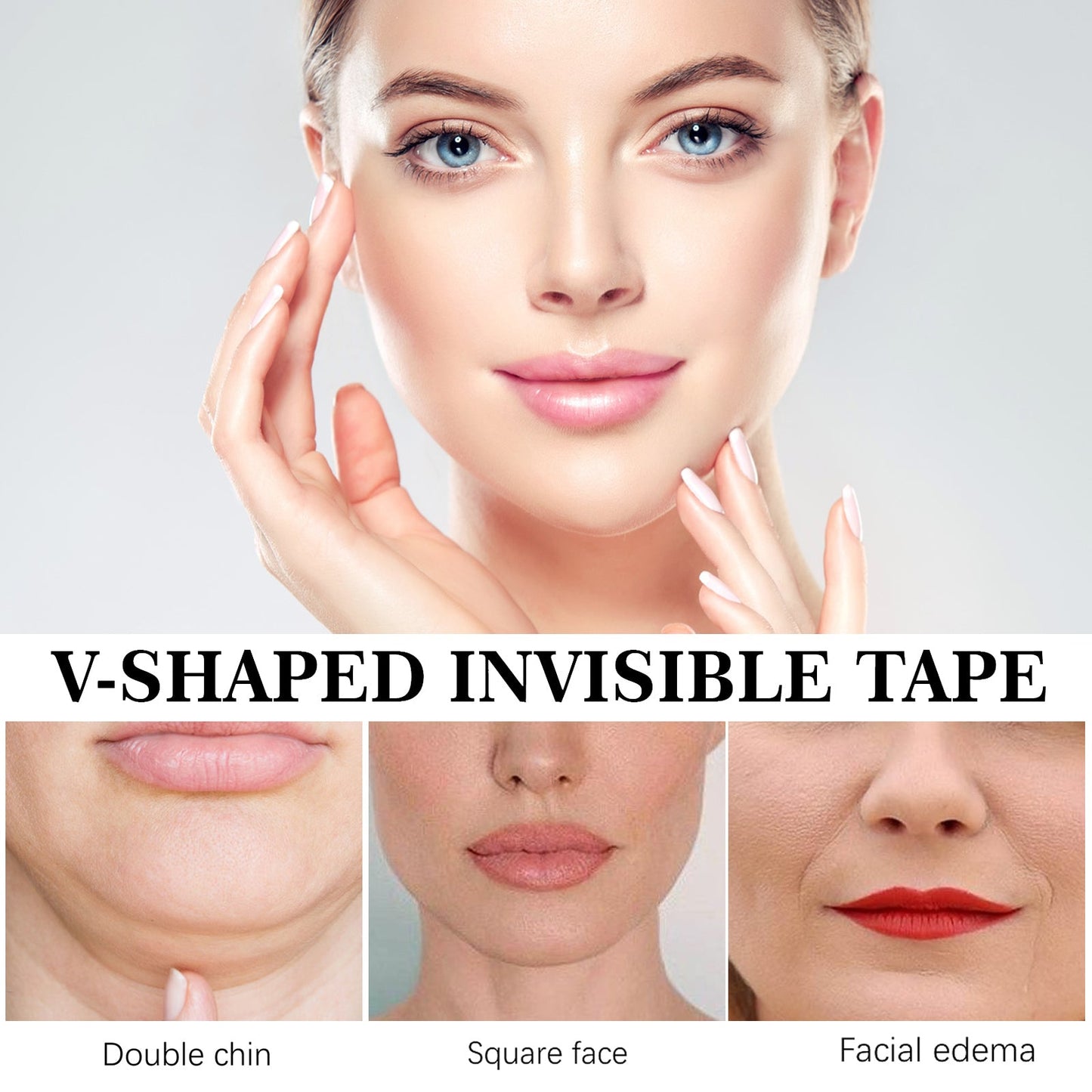 Invisible Lifting Patch for a Defined V-Face