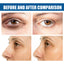 Collagen Eye Mask Removes Fine Lines And Dark Circles Hydrating And Firming Lift Crystal Eye Mask - Korvel