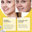 Star Acne Patch Clear Acne Skin Care Facial Cover Acne Invisible Acne Patch - Korvel