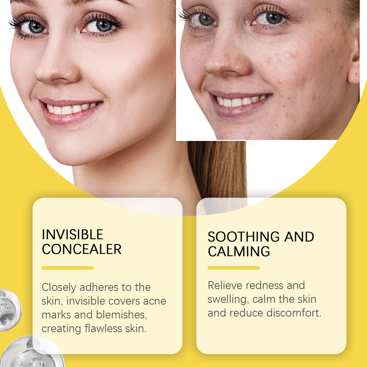 Star Acne Patch Clear Acne Skin Care Facial Cover Acne Invisible Acne Patch - Korvel