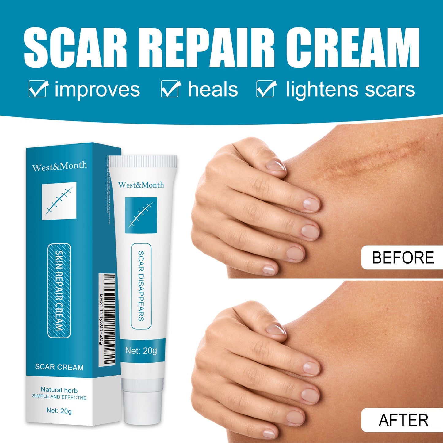Skin Repair Cream Gentle Moisturizing Hydrating Moisturizing Repair Skin Care Repair Cream - Korvel