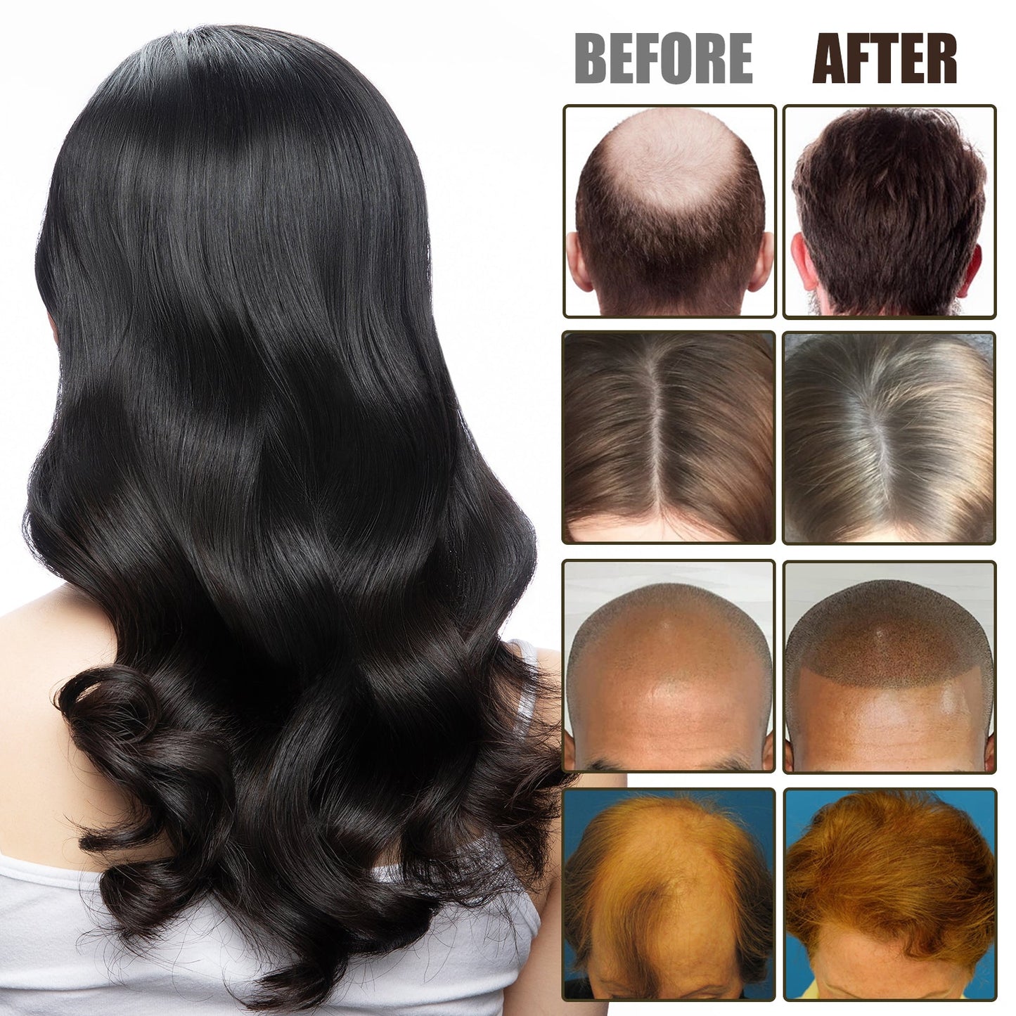 NMN Scalp Cell Revitalizing Hair Essence