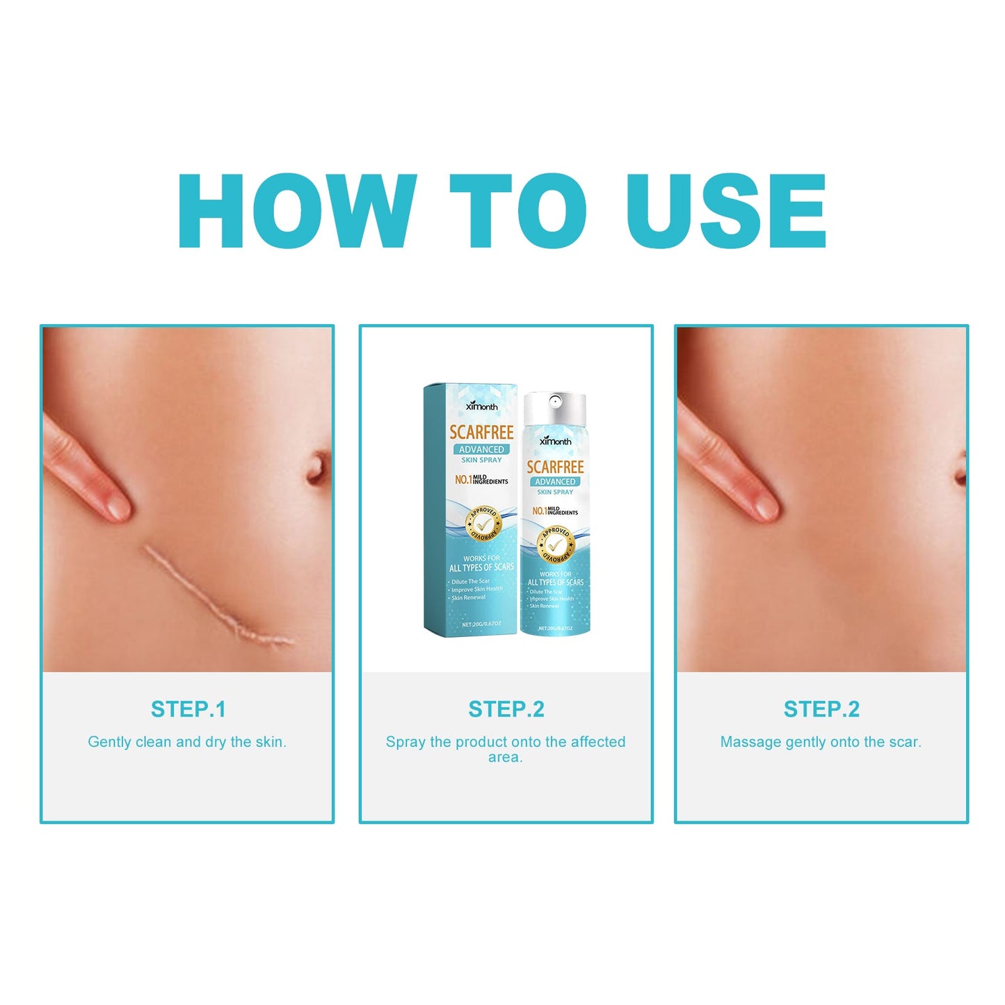 Scarfree Advanced Skin Spray, Body Skin Care Reduces Post-Natal Scars And Smooths Skin - Korvel
