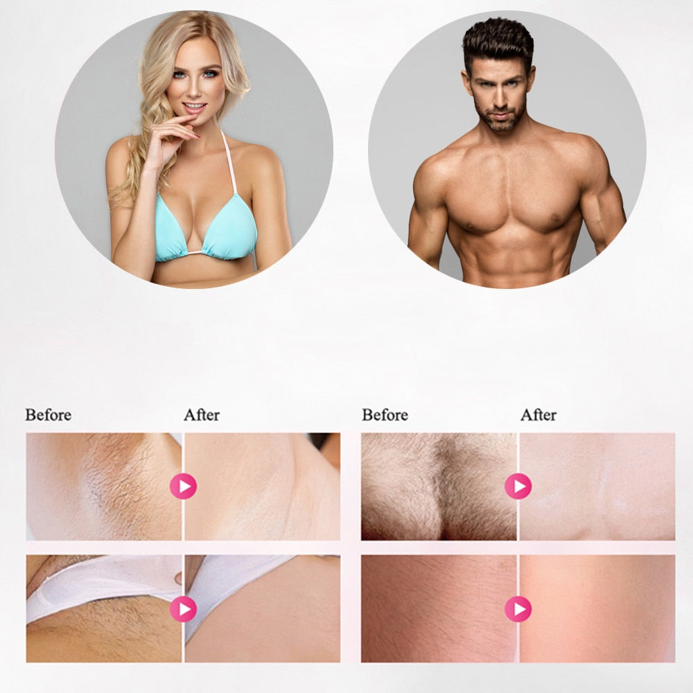Appareil d'épilation au laser IPL LippyTime