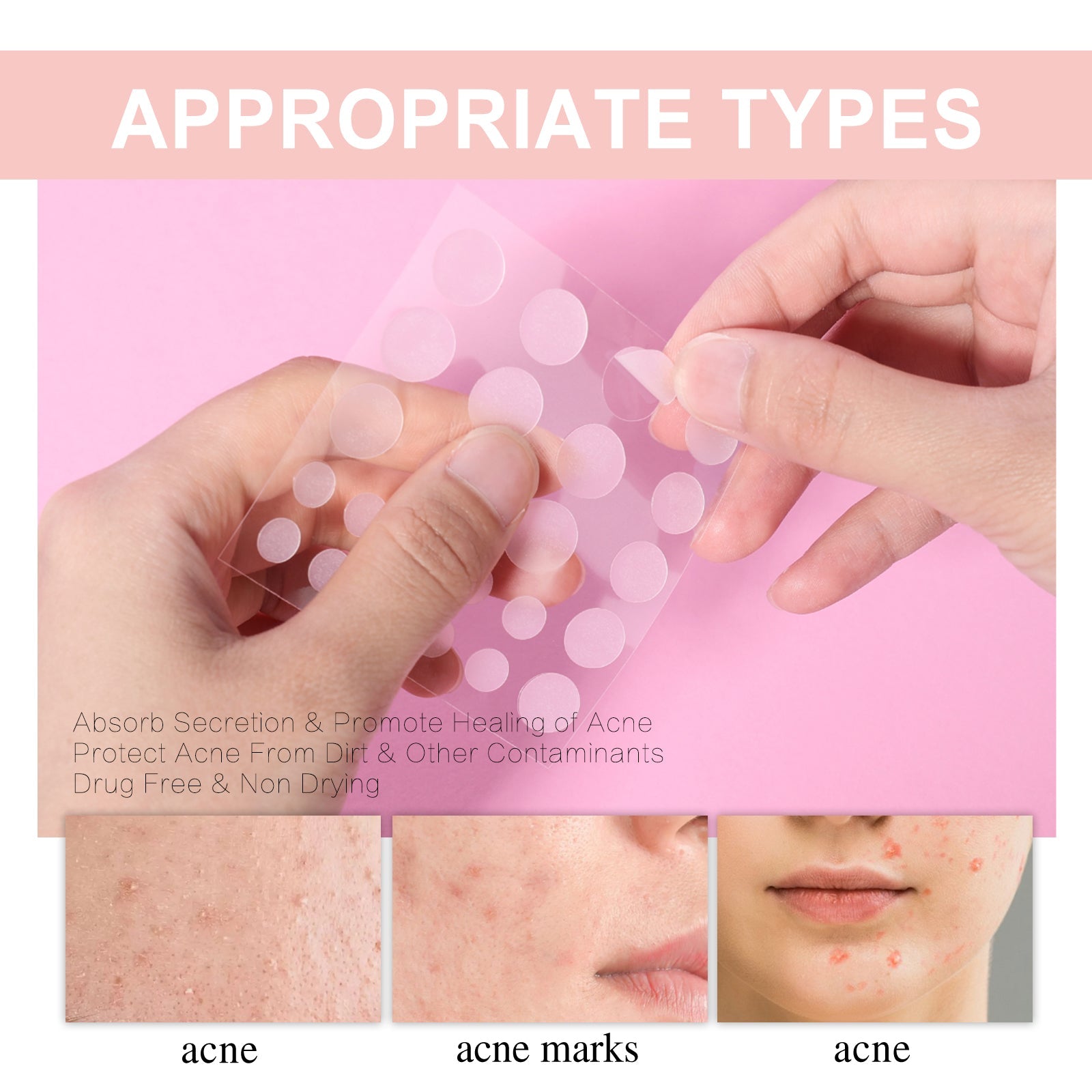 Acne Patch, Repair Acne Pimples Acne Invisible Concealer Breathable Acne Patch - Korvel