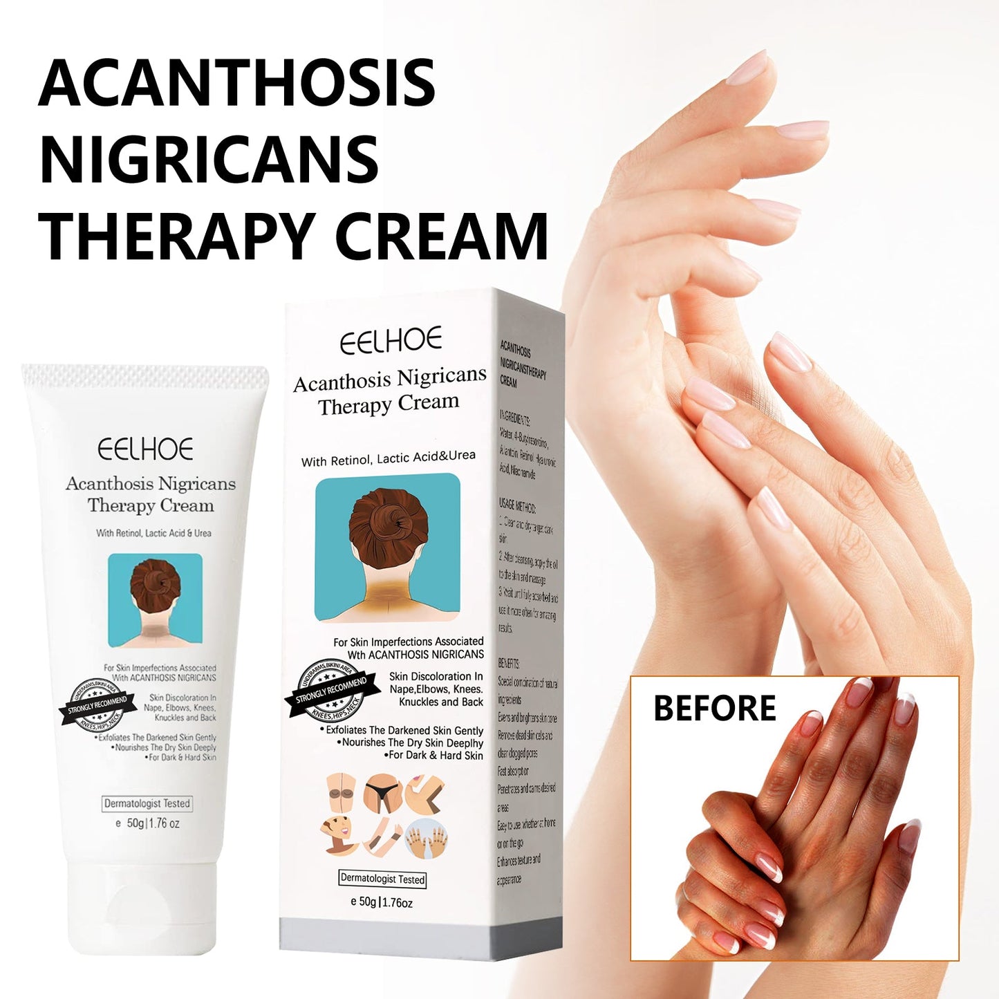Black Acanthoderm Repair Cream Repair Underarm Arm Knee Joint Black Moisturizing Whitening Body Care Cream - Korvel