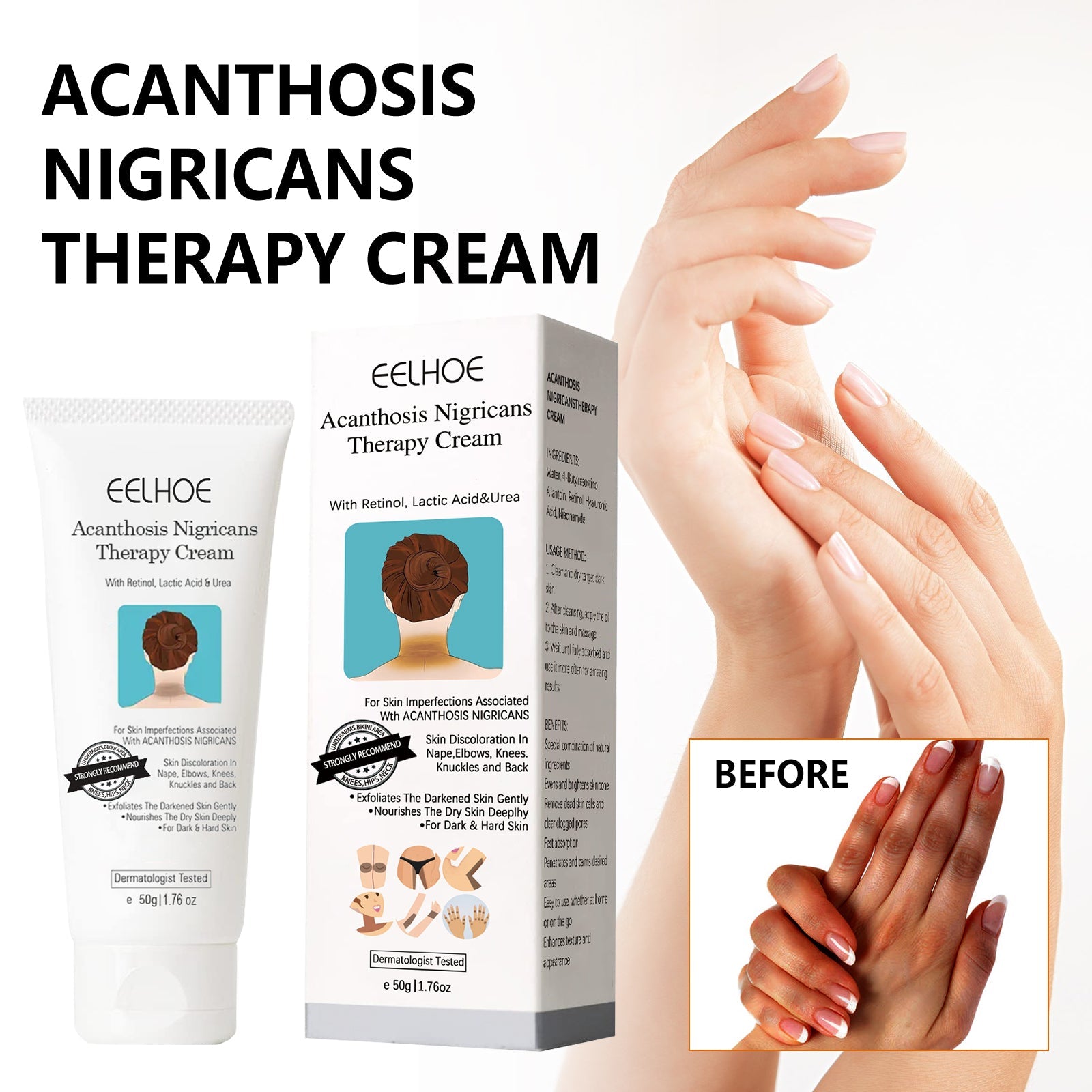 Black Acanthoderm Repair Cream Repair Underarm Arm Knee Joint Black Moisturizing Whitening Body Care Cream - Korvel