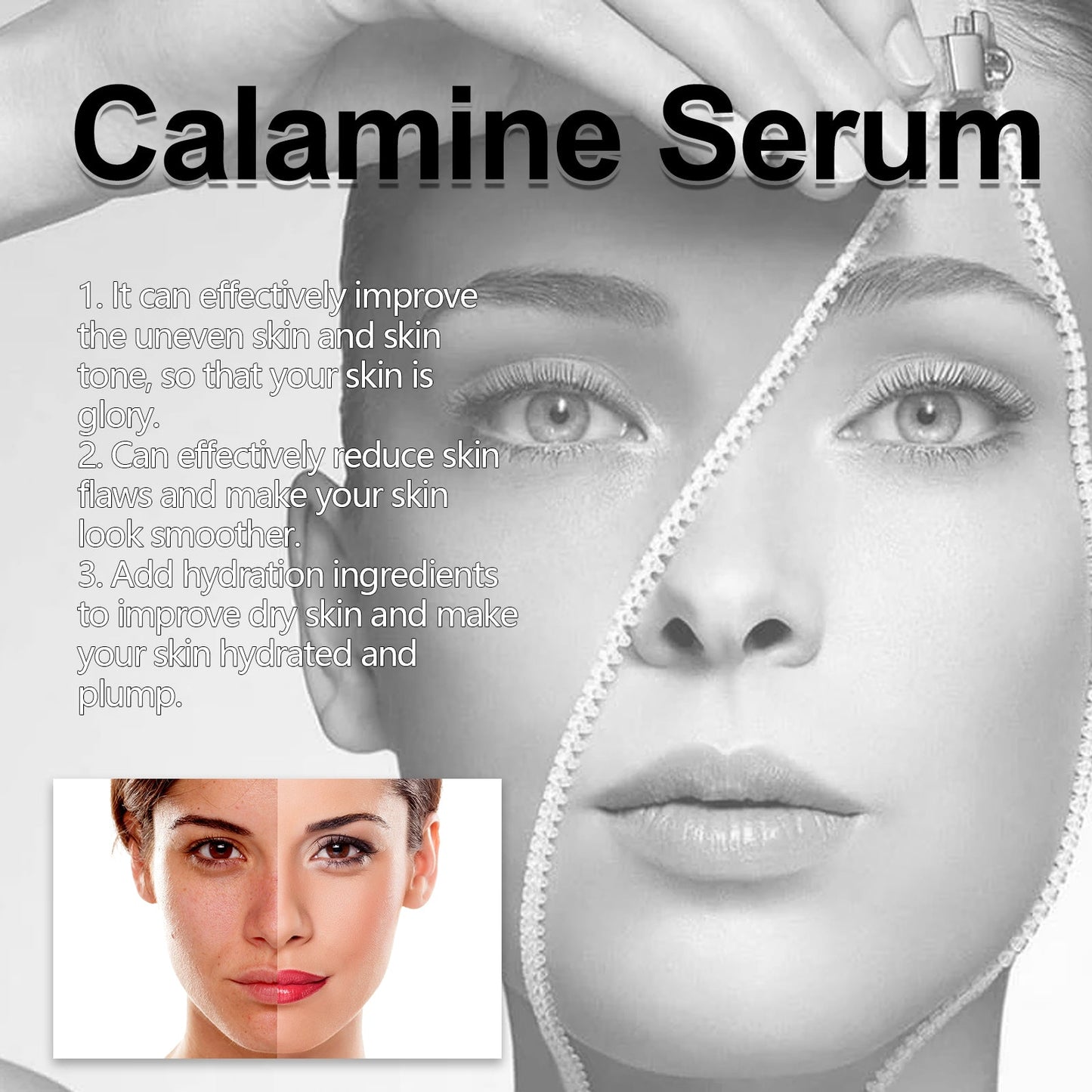 Calamine Serum, Improve Skin Dry Dull Acne Muscle Acne Hydrating Plump - Korvel