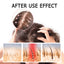 King Of Ginger, Hair Root Nourishing And Thickening Hair Strong Anti-Scalp Massage Treatment Capsule - Korvel