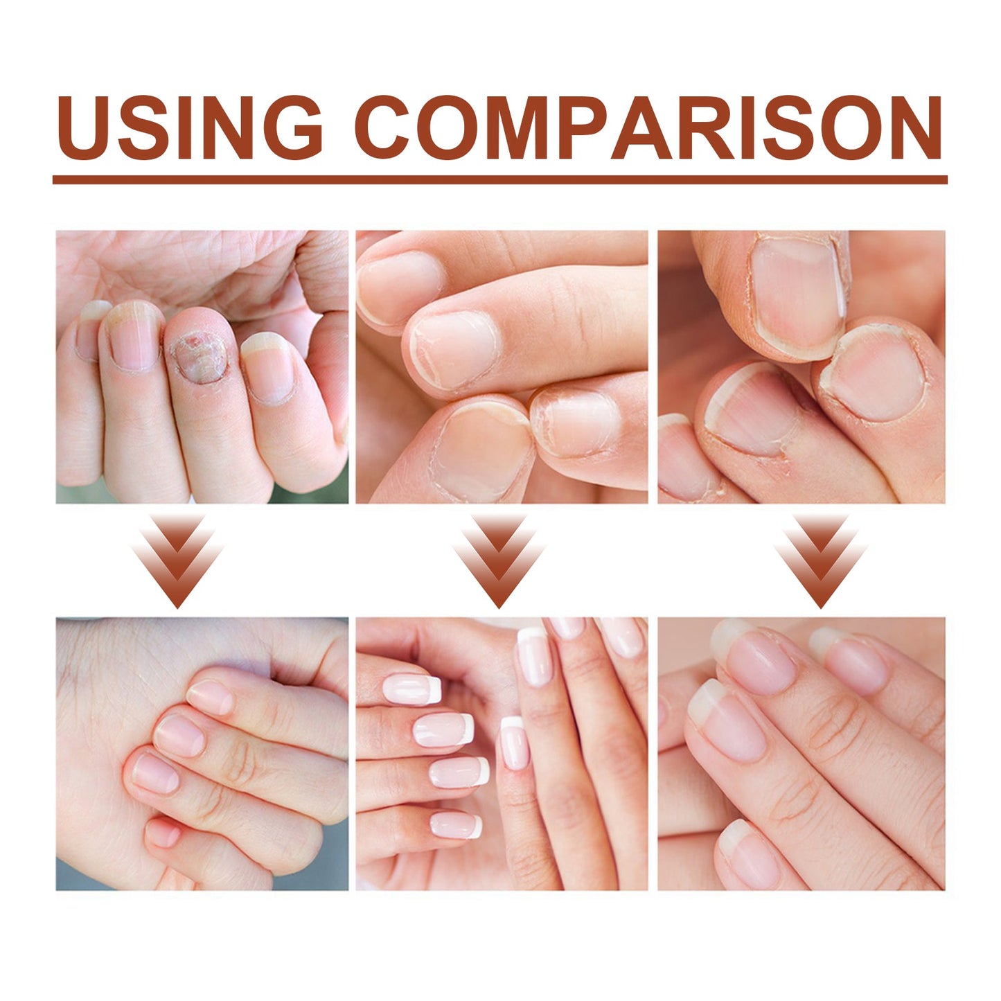 7 Day Nail Care Essence - Nourishing Cleansing Treatment