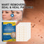 Wart Removers Seal & Heal Patches, Lightening Mole Gram Wart Repair Meat Grain Callus Corns Skin Clean And Smooth Patch - Korvel