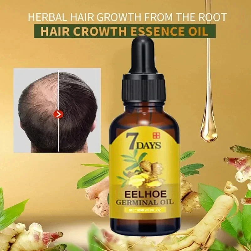 7 Day Fast Hair Growth Oil Ginger Growth Hair Treatment Anti Hair Loss Men Women Scalp Treatment Serum Products Beauty Product - Korvel