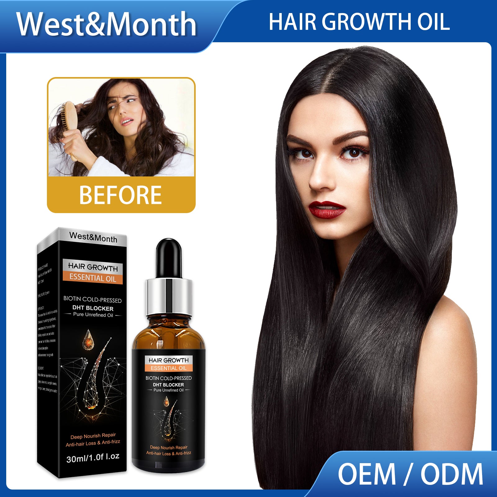 Hair Growth Essential Oil, Dense Hair Growth Repair Dry Hair And Moisture Hair Essence - Korvel