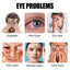Wormwood Eye Care Sticker Box, Stay Up Late Eye Dry Eye Astringent Cold Compress Stick Moxibustion Students Eye Care Patch Vision - Korvel