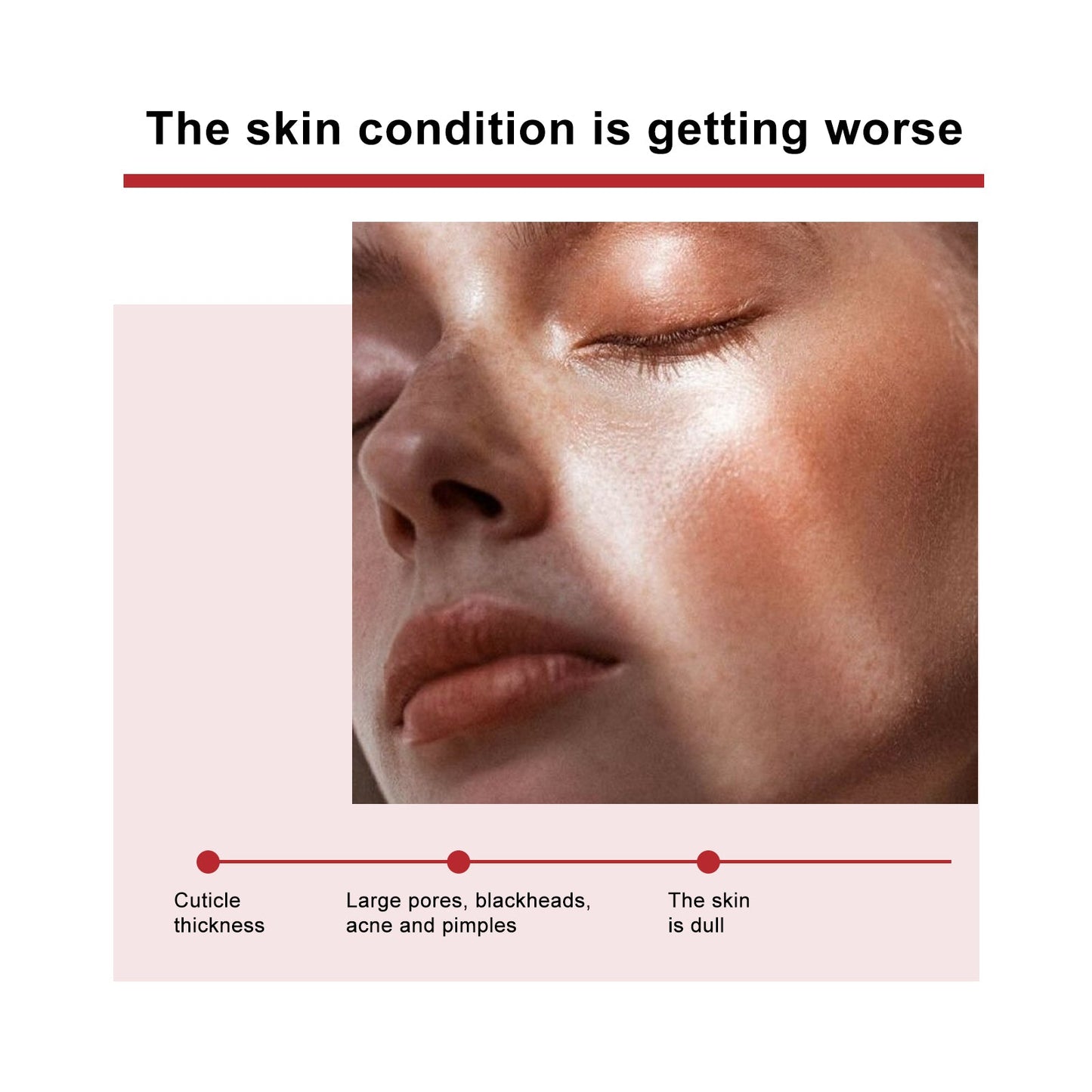 Mandelic Acid Daily Update Essence, Acne-Removing And Acne-Closing Repair Brightening Fruit Acid Essence - Korvel