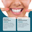 Silicone Denture Repair Set, Everyday To Enhance The Beauty Of Smile Comfortable Material Modification Teeth - Korvel