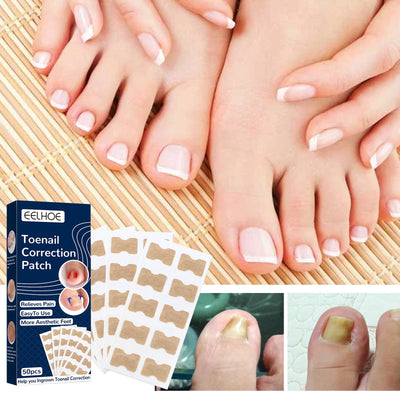 Nail Correction Patch, Nail Insert Correction And Repair Toe Manicure Nail Patch - Korvel