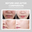 Hydrating Cream Hydrating And Lightening Facial Acne Repair Redness Hydrating And Brightening Moisturizing Cream - Korvel