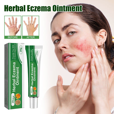 Herbal Eczema Relief Ointment for Hands and Feet