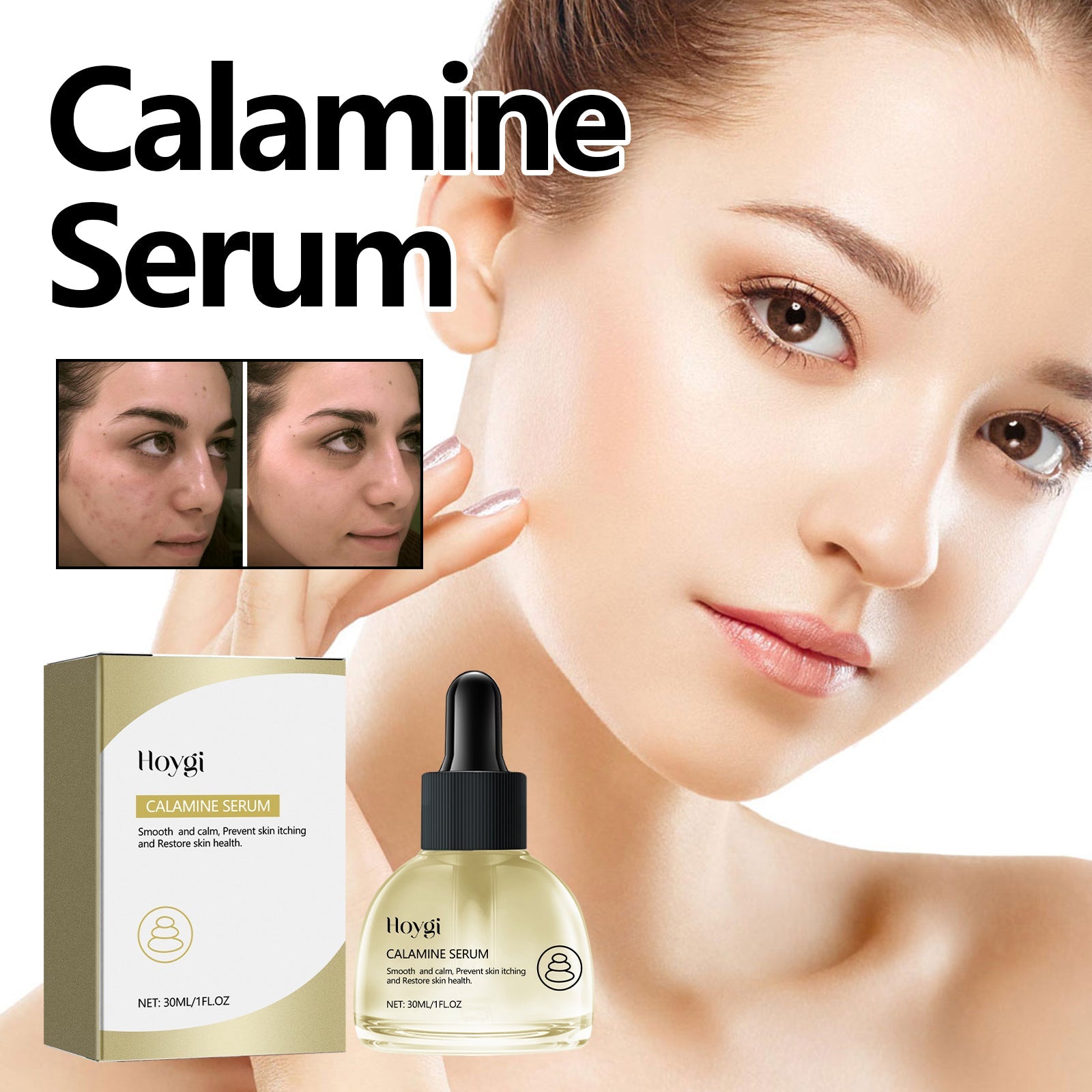 Calamine Serum, Improve Skin Dry Dull Acne Muscle Acne Hydrating Plump - Korvel