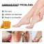 Anti-Crack Hand And Foot Care Cream Moisturizes Skin To Prevent Dry Cracking, Peeling, Freezing And Chapping - Korvel