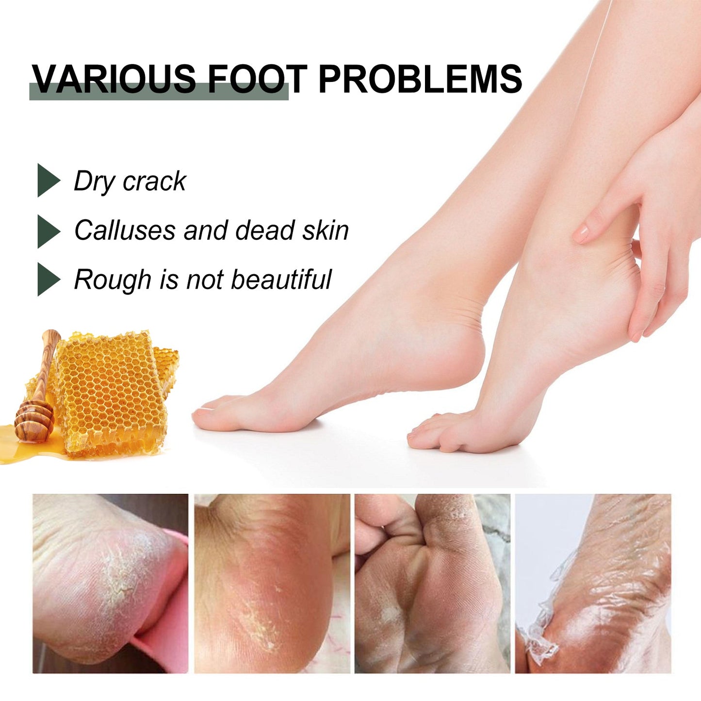 Anti-Crack Hand And Foot Care Cream Moisturizes Skin To Prevent Dry Cracking, Peeling, Freezing And Chapping - Korvel
