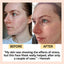 Kaolin Clay Face Mask - Korvel