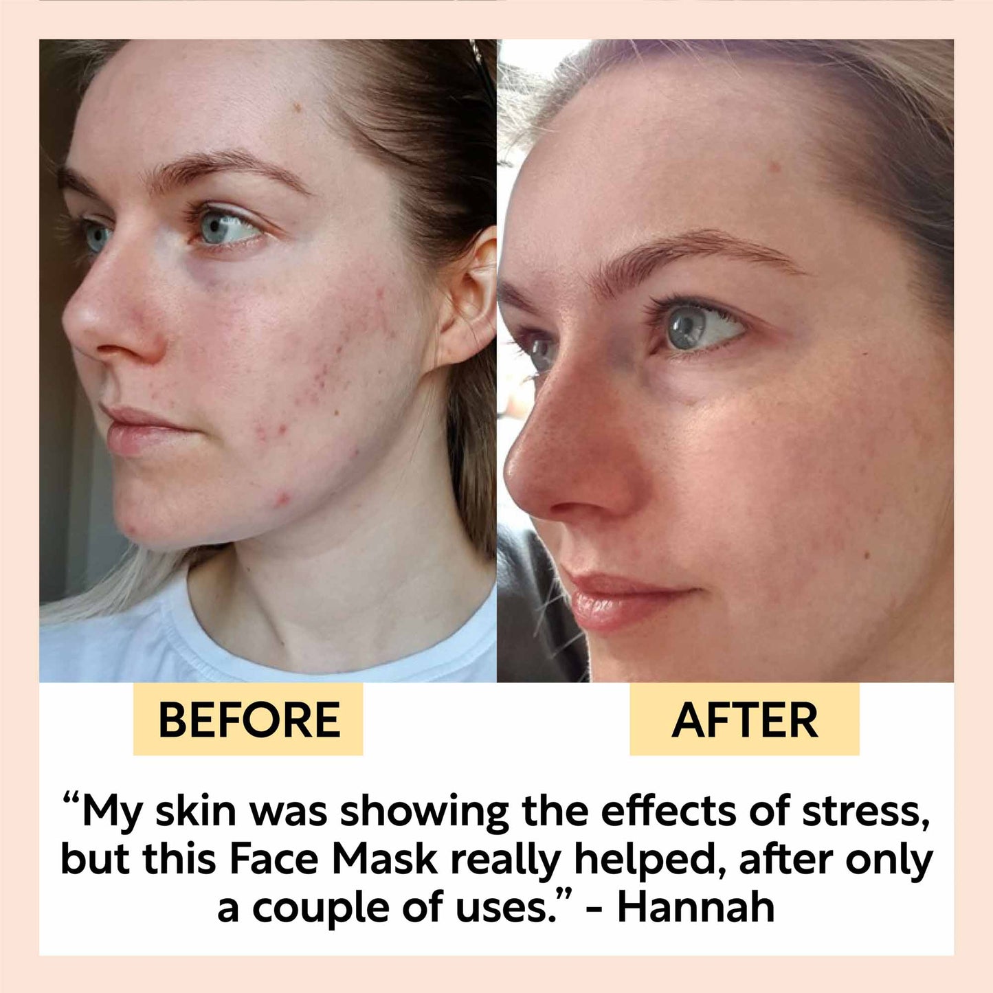 Kaolin Clay Face Mask - Korvel