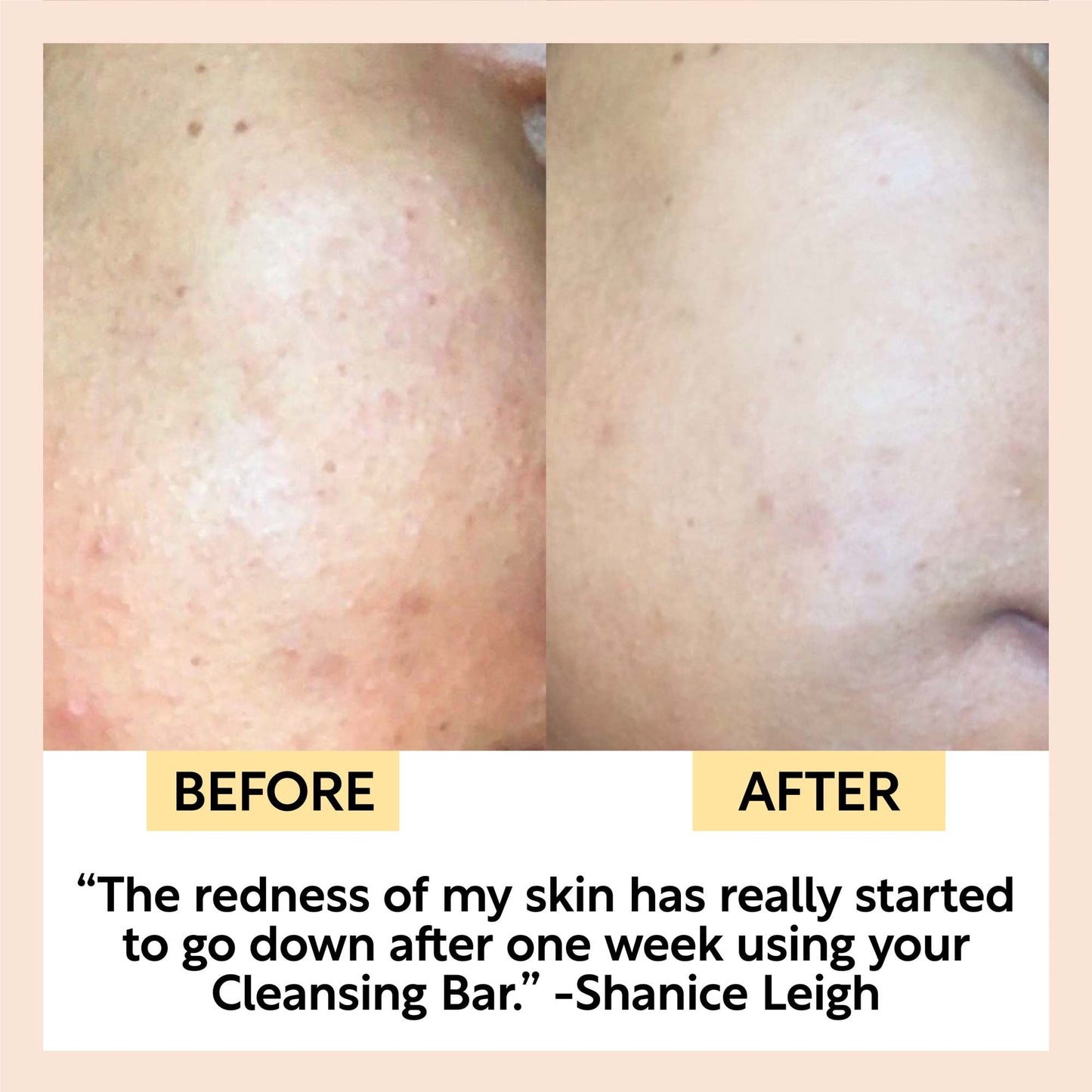 Cinnamon + Ginger Cleansing Bar - Korvel