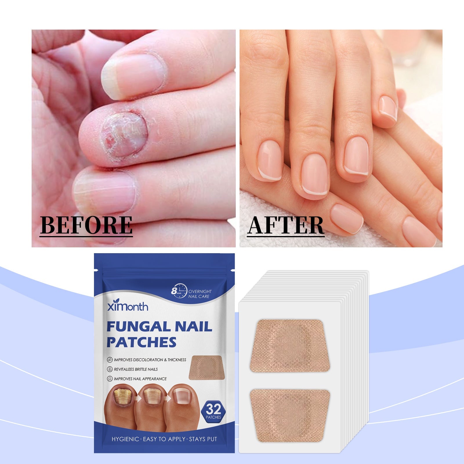 Nail Care Patches Gently Repair Nails For Easy Daily Cleaning With Simple Care Patches - Korvel