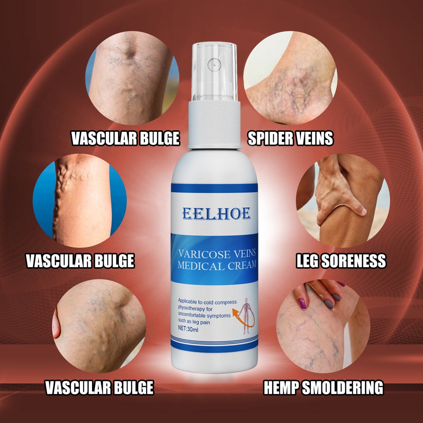 Intravenous Massage Spray For Varicose Veins Relief And Earthworm Leg Blood Vessel Bulge Pain Spray - Korvel
