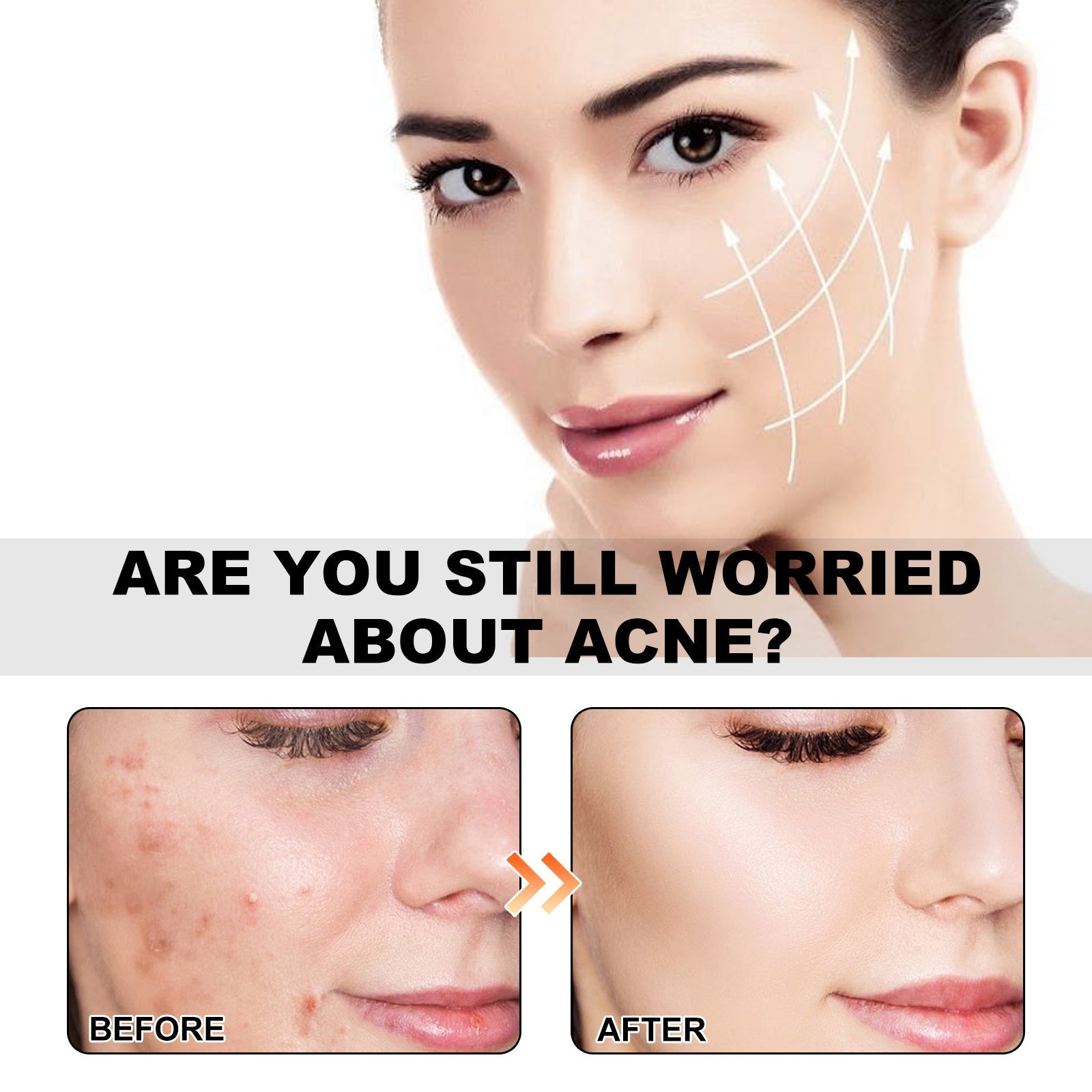 Sea Life Pattern Acne Patches, Lighten Acne Acne Repair Facial Skin Concealer Acne Patch - Korvel