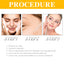 Vitamin C Face Serum, Anti-Aging Fade Facial Spots Wrinkles Brightening Skin - Korvel