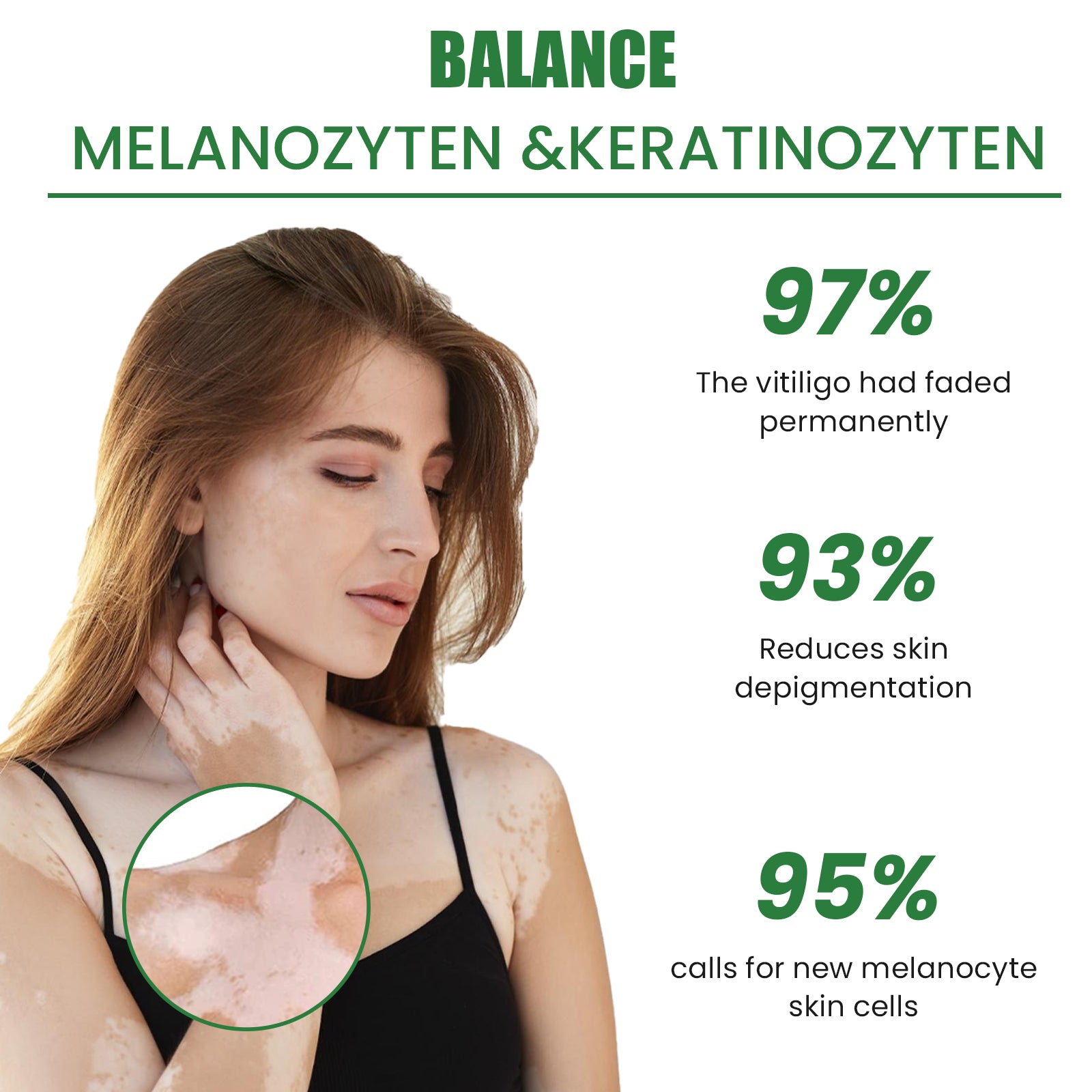 White Spot Repair Cream Skin White Spot Melanin Repair Even Skin Tone Topical Care Cream - Korvel