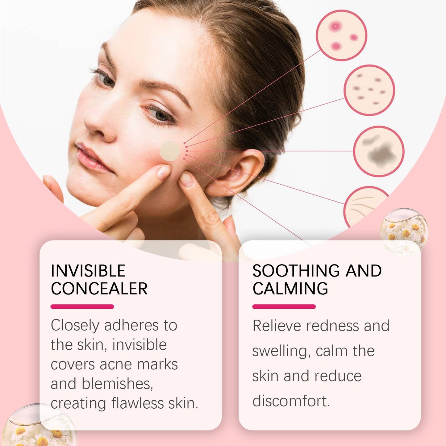 Repair Acne Patch, Facial Cleansing Cover Acne Skin Moisturizing Gentle Skin Cream - Korvel